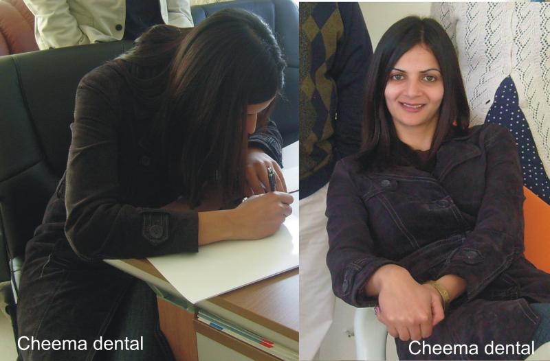 immediate extraction of 2 milk teeth and immediate placement of implant & crown